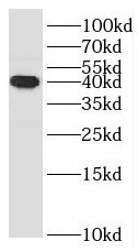 SMPDL3B Antibody - BSA Free