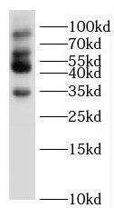 SLMAP Antibody - BSA Free