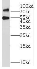 SLCO6A1 Antibody - BSA Free