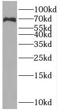 SLC6A8 Antibody - BSA Free
