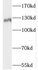 SLC4A8 Antibody - BSA Free