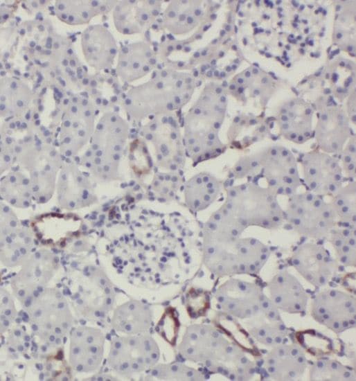 SLC38A4 Antibody - BSA Free