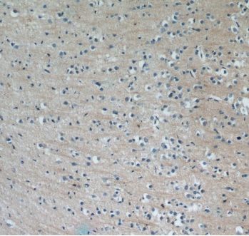 MLK4 Antibody - BSA Free