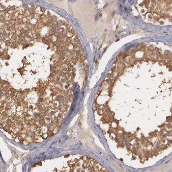 MLF1 Interacting Protein Antibody - BSA Free
