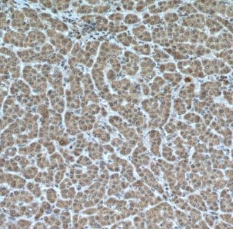 MKS1 Antibody - BSA Free