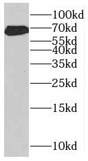 MKS1 Antibody - BSA Free