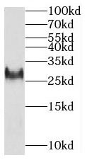 MITD1 Antibody - BSA Free