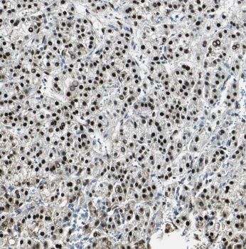 MIPOL1 Antibody - BSA Free