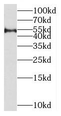 MIPOL1 Antibody - BSA Free