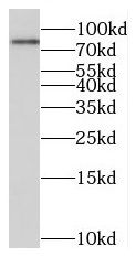 MIER1 Antibody - BSA Free