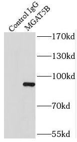 MGAT5B Antibody - BSA Free