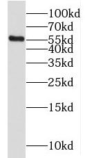 MGAT2 Antibody - BSA Free