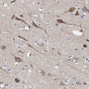 MFSD8 Antibody - BSA Free