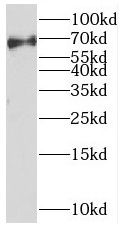 MEX3C Antibody - BSA Free