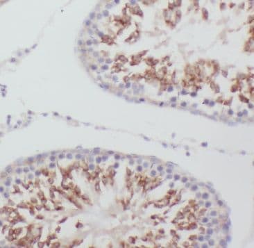 MEX3C Antibody - BSA Free