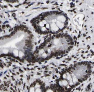 methyltransferase like 9 Antibody - BSA Free