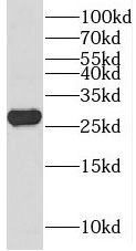 METTL7B Antibody - BSA Free