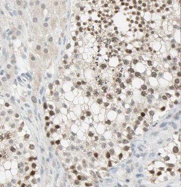 Methyltransferase like 6 Antibody - BSA Free