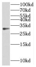 Methyltransferase like 6 Antibody - BSA Free