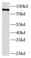 MEFV Antibody - BSA Free