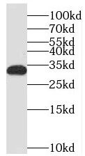 MEF2BNB Antibody - BSA Free
