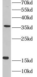 MED10 Antibody - BSA Free
