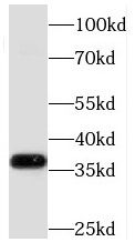 MECR Antibody - BSA Free