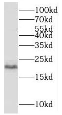 MCTS1 Antibody - BSA Free