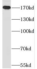 MAST1 Antibody - BSA Free