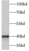 MARVELD3 Antibody - BSA Free