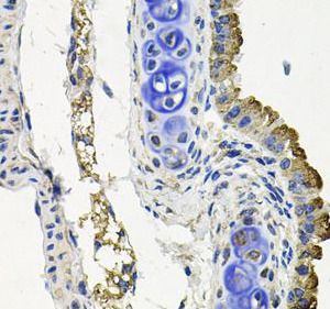 MARK1 Antibody - BSA Free