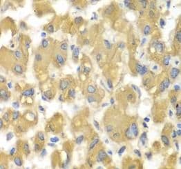 MAP4K3 Antibody - BSA Free