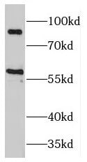 MAP4K2 Antibody - BSA Free