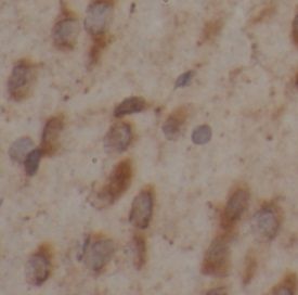 MANBAL Antibody - BSA Free