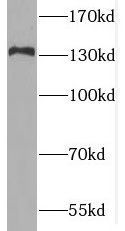 MAN2B2 Antibody - BSA Free