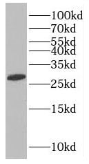 MAGEH1 Antibody - BSA Free
