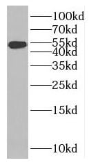 MAGED4B Antibody - BSA Free