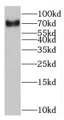 MAGEC3 Antibody - BSA Free