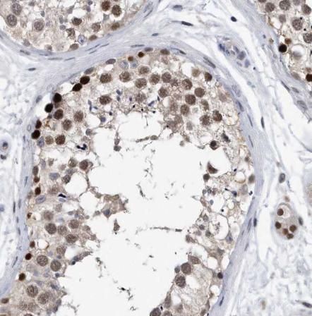 Melanoma antigen family C2 Antibody - BSA Free