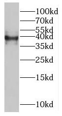 MAGEB4 Antibody - BSA Free