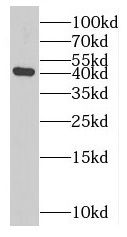 MAGEA10 Antibody - BSA Free