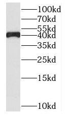 MAB21L2 Antibody - BSA Free