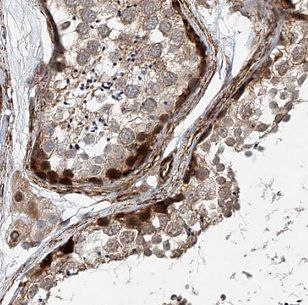 LYZL6 Antibody - BSA Free