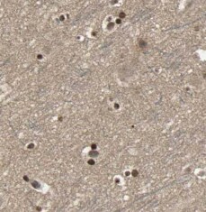 Cav1.2 Antibody - BSA Free