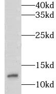LSM7 Antibody - BSA Free