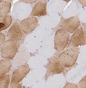 LRSAM1 Antibody - BSA Free