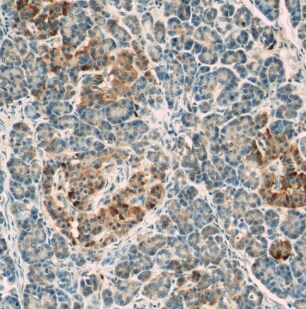 LRRC47 Antibody - BSA Free