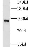 LRRC41 Antibody - BSA Free