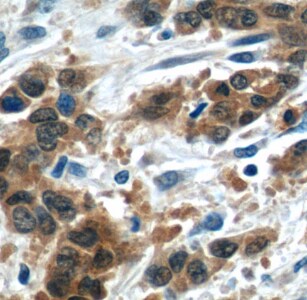 LRRC20 Antibody - BSA Free