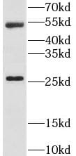LRAT Antibody - BSA Free